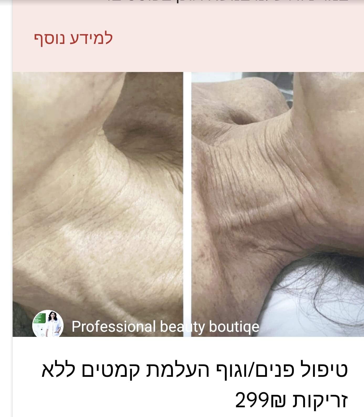 קוסמטיקאיות | אולגה שמעון קוסמטיקאית פרא רפואית