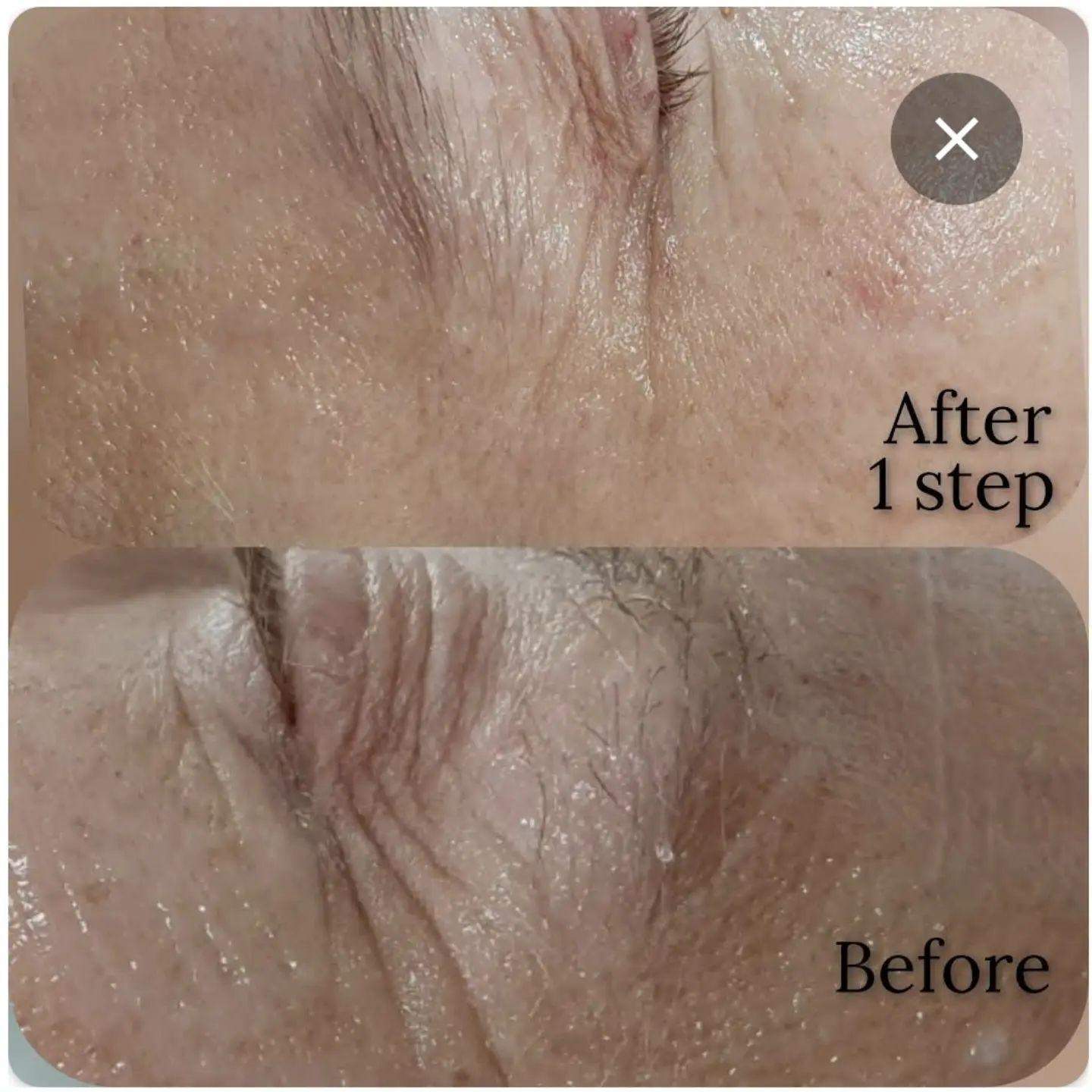 קוסמטיקאיות | אולגה שמעון קוסמטיקאית פרא רפואית