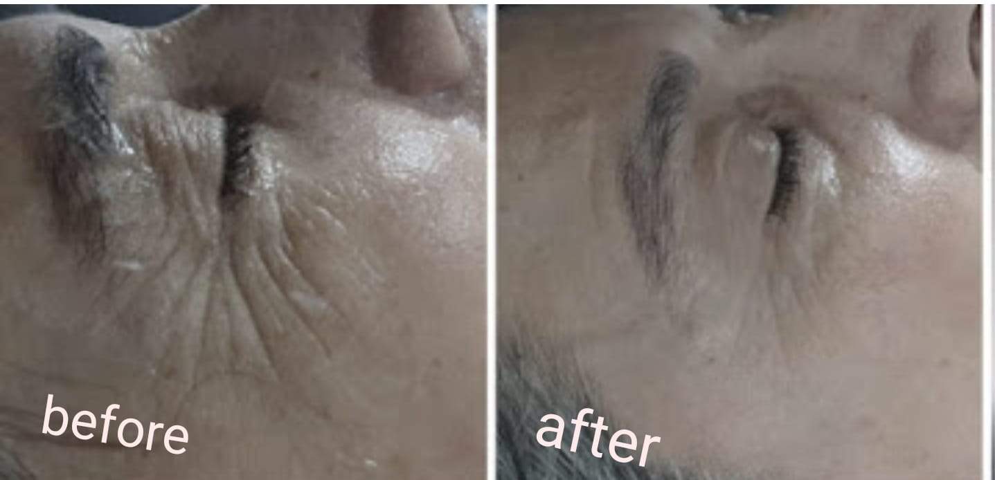 קוסמטיקאיות | אולגה שמעון קוסמטיקאית פרא רפואית