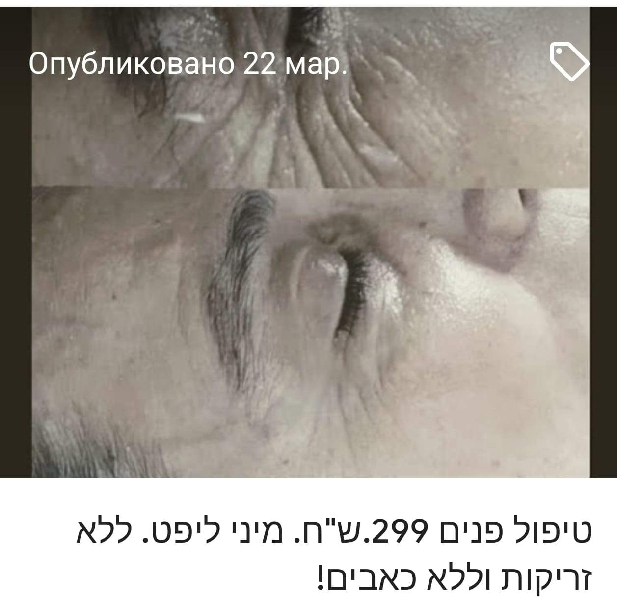 קוסמטיקאיות | אולגה שמעון קוסמטיקאית פרא רפואית