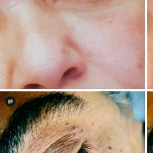 Косметологи | Ольга Шимон косметолог пара-медицинский