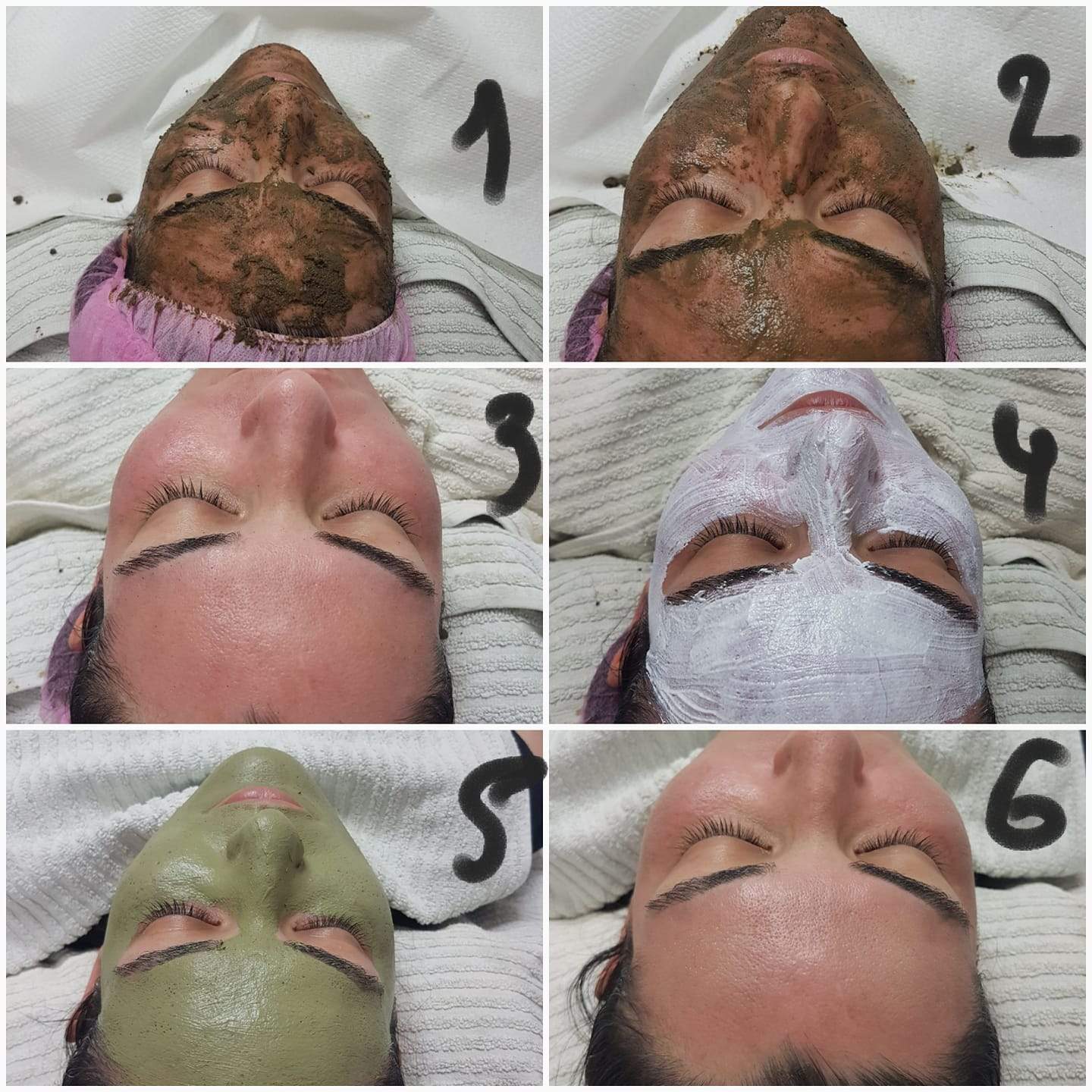 קוסמטיקאיות | סופיה מכון לקוסמטיקה רפואית