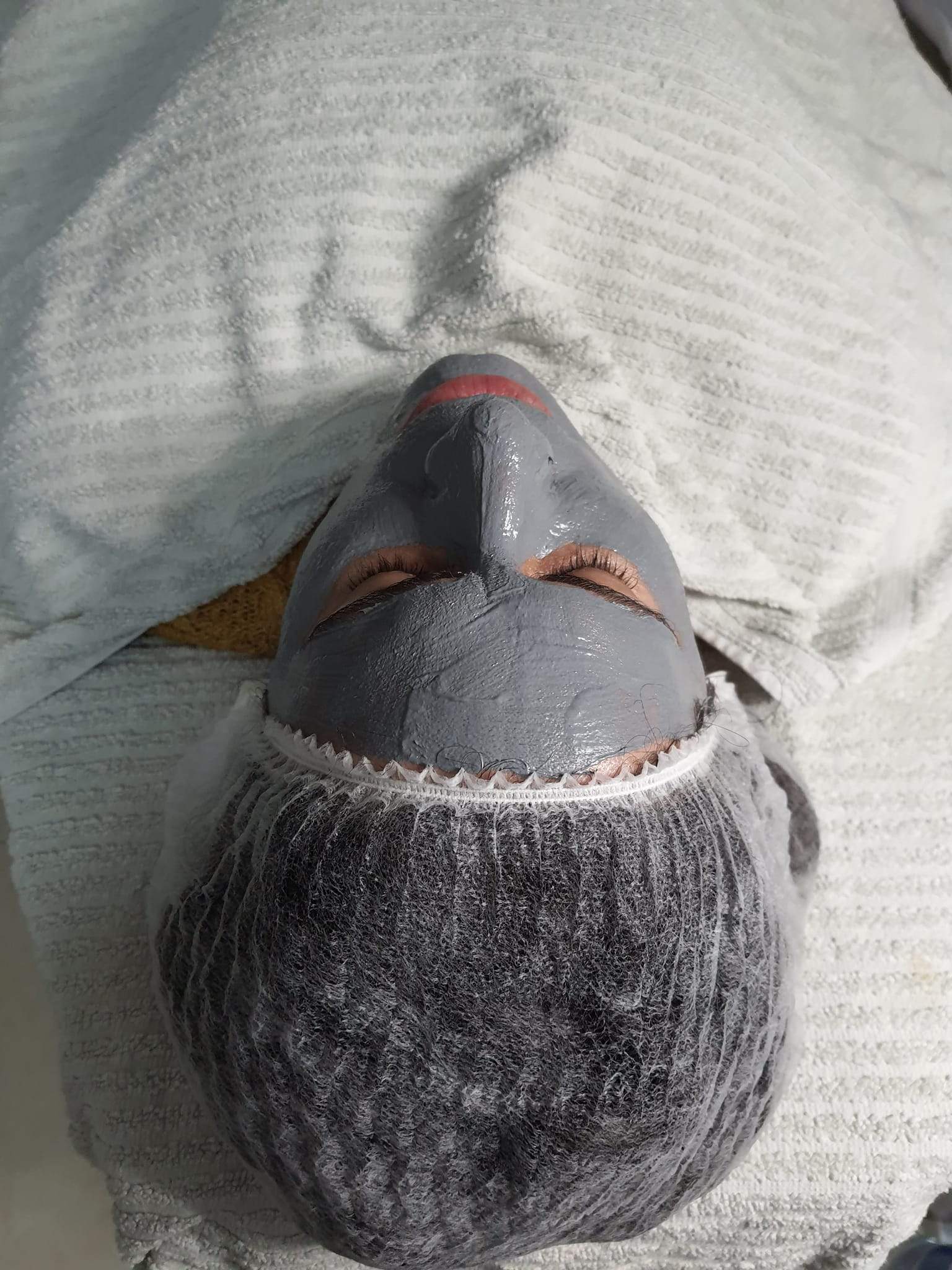 קוסמטיקאיות | סופיה מכון לקוסמטיקה רפואית