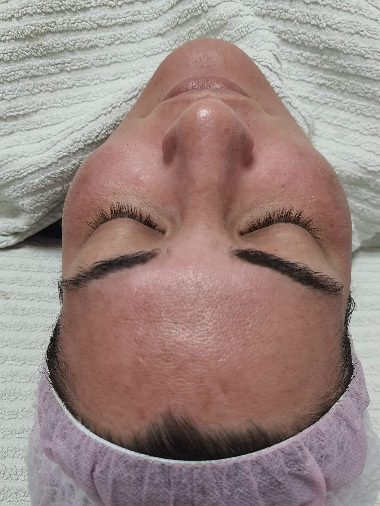 קוסמטיקאיות | סופיה מכון לקוסמטיקה רפואית