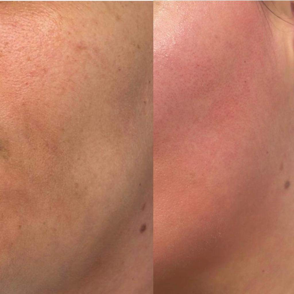 קוסמטיקאיות | אמירה צדקיהו