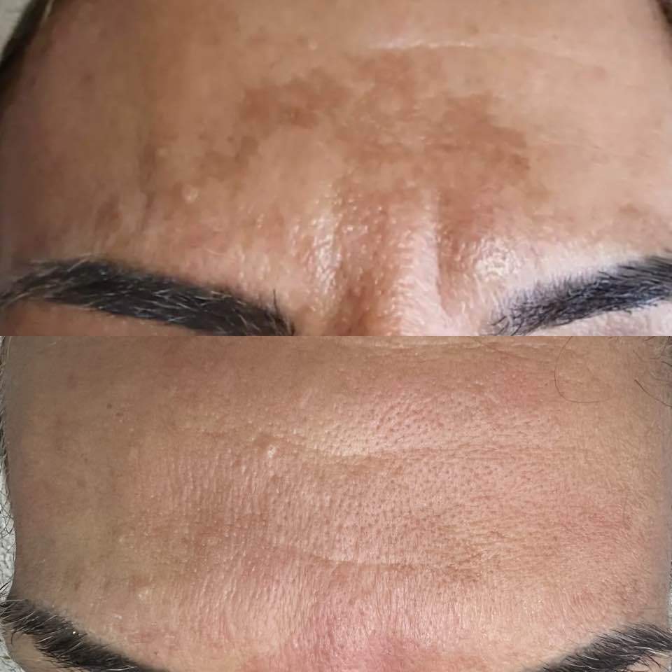 קוסמטיקאיות | סטודיו מרלין טיפוח ואסתטיקה