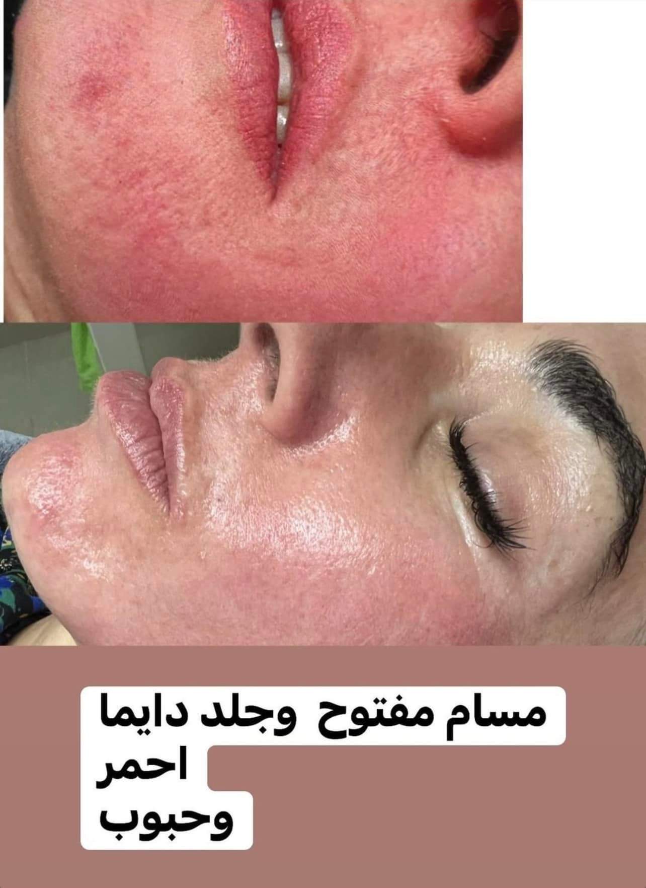 קוסמטיקאיות | סטודיו מרלין טיפוח ואסתטיקה