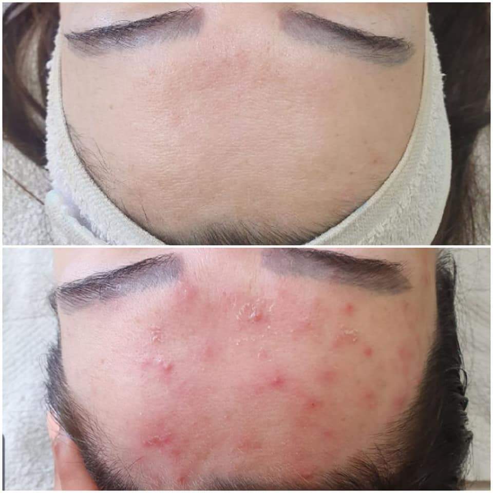 קוסמטיקאיות | סטודיו מרלין טיפוח ואסתטיקה