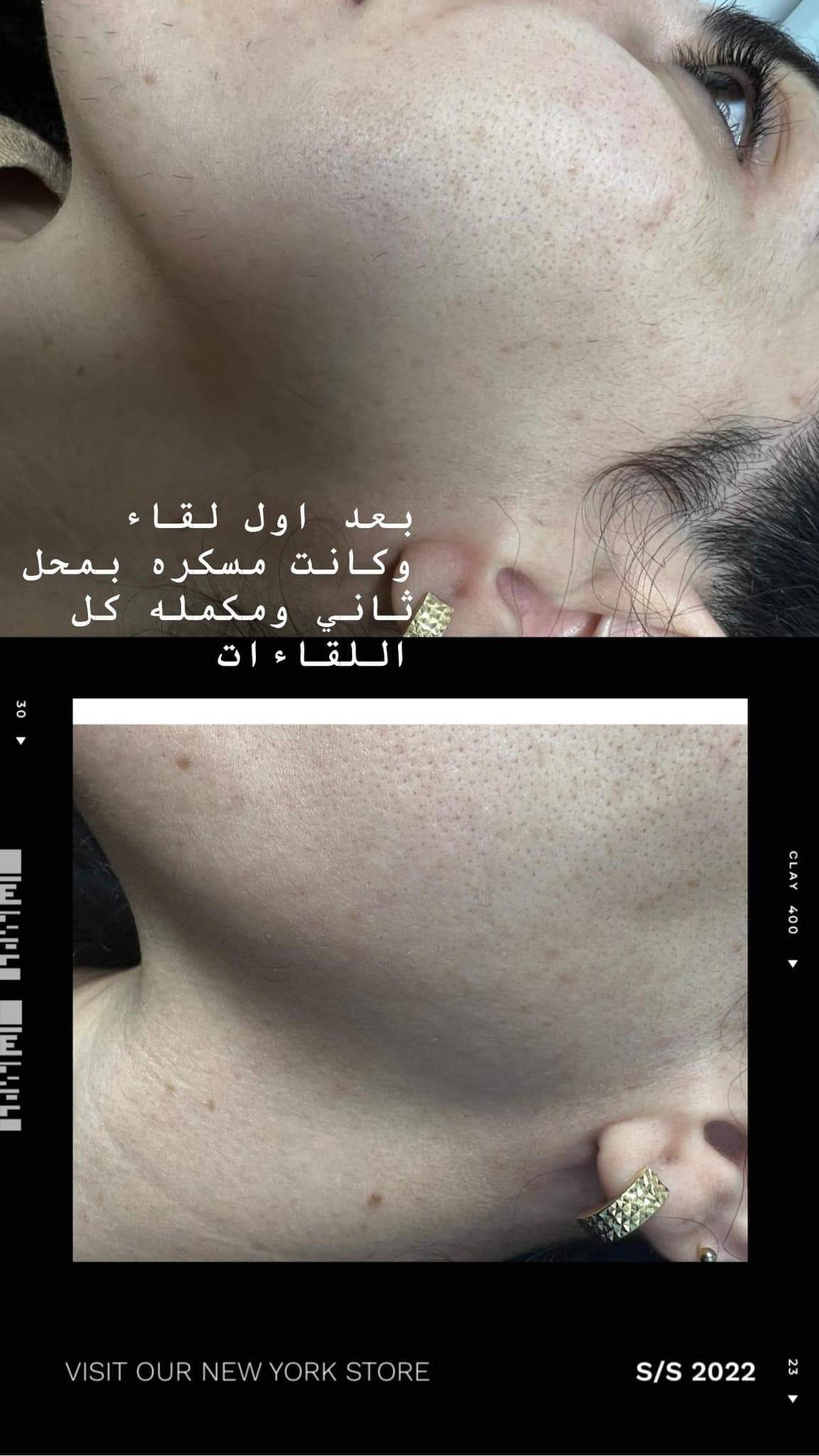 קוסמטיקאיות | סטודיו מרלין טיפוח ואסתטיקה