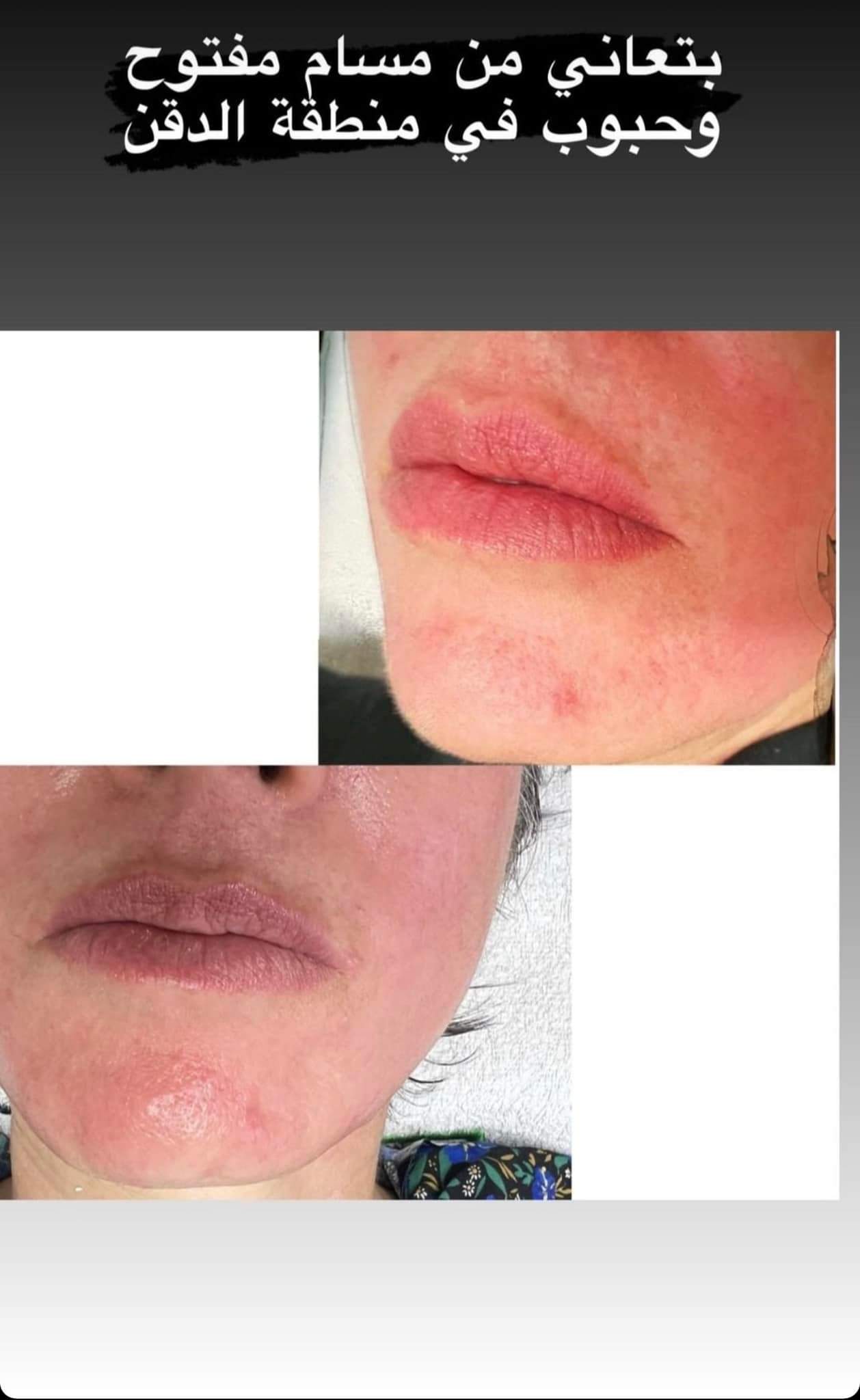 קוסמטיקאיות | סטודיו מרלין טיפוח ואסתטיקה