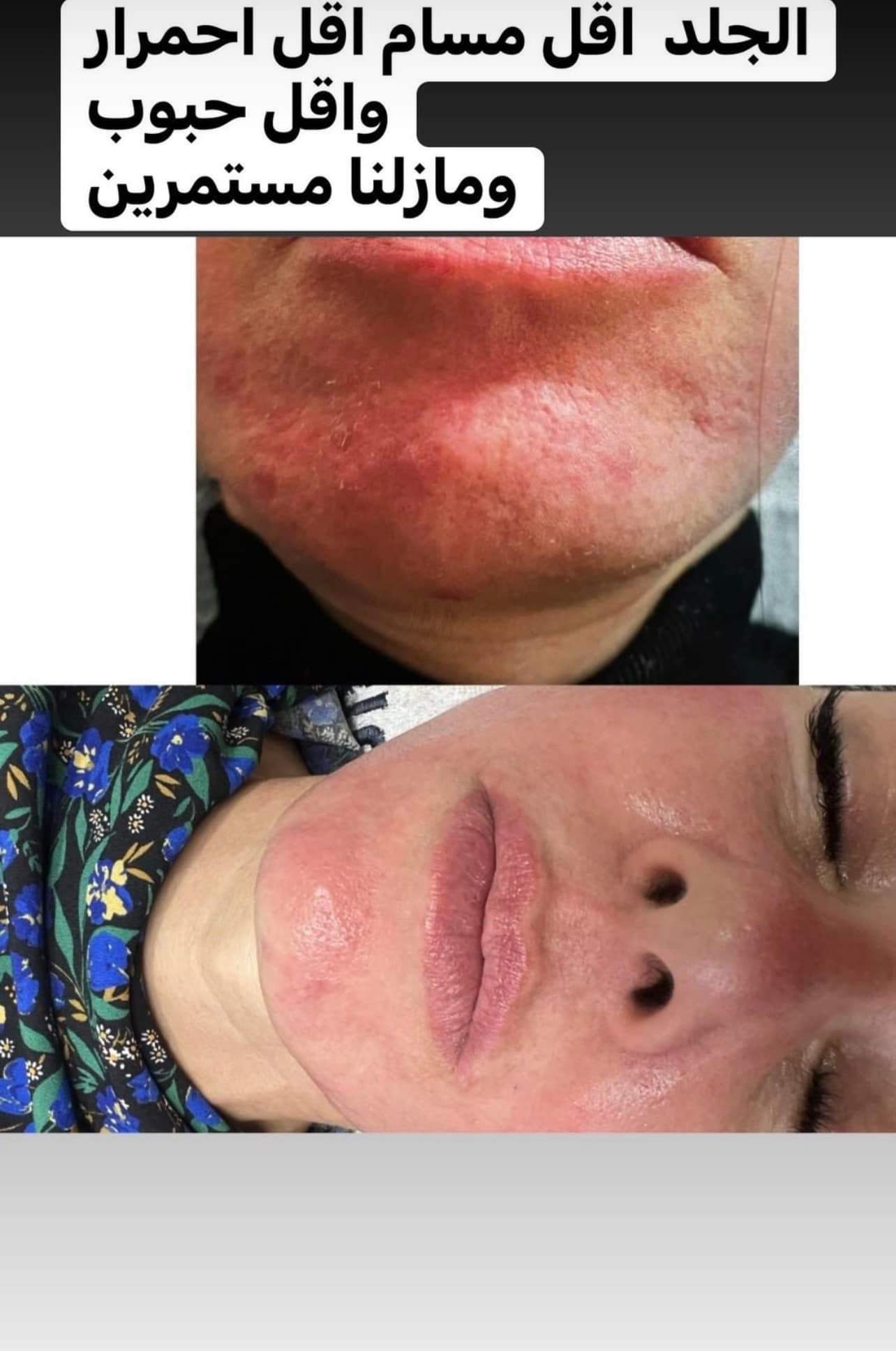 קוסמטיקאיות | סטודיו מרלין טיפוח ואסתטיקה