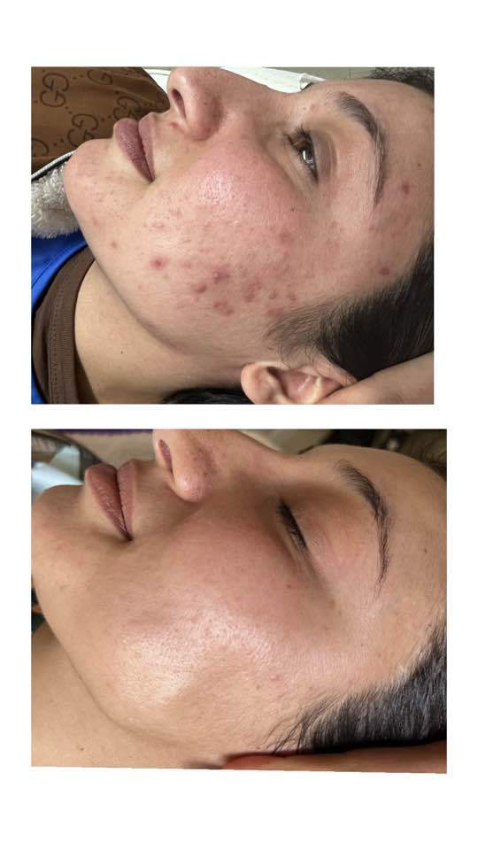 קוסמטיקאיות | סטודיו מרלין טיפוח ואסתטיקה