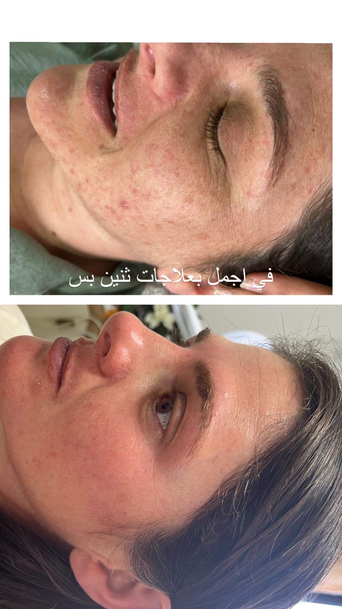 קוסמטיקאיות | סטודיו מרלין טיפוח ואסתטיקה