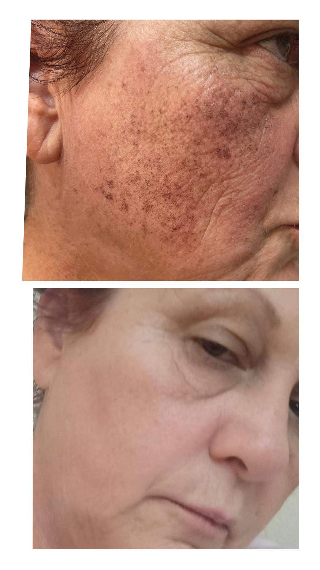 קוסמטיקאיות | סטודיו מרלין טיפוח ואסתטיקה