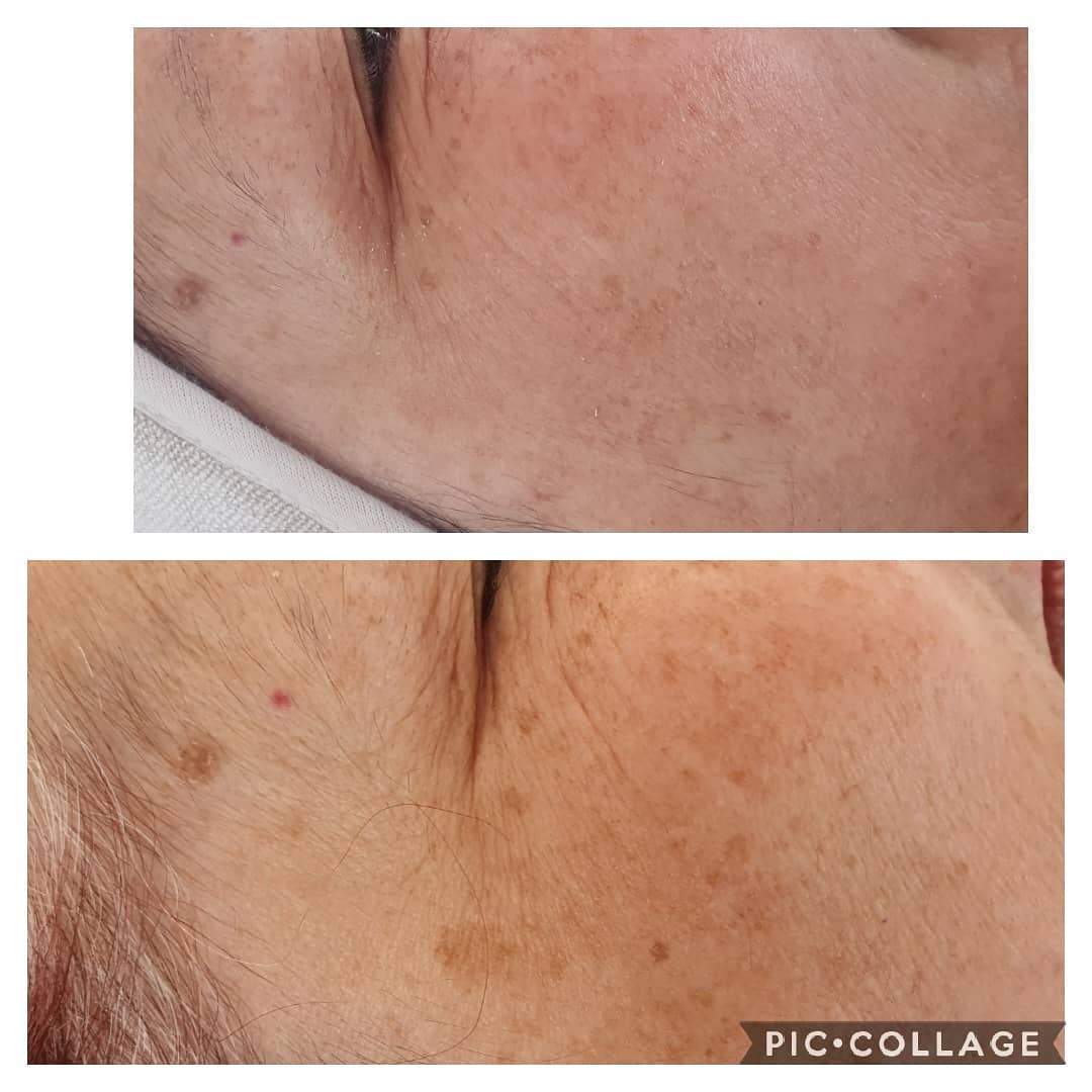 קוסמטיקאיות | לורנס סקין קאר