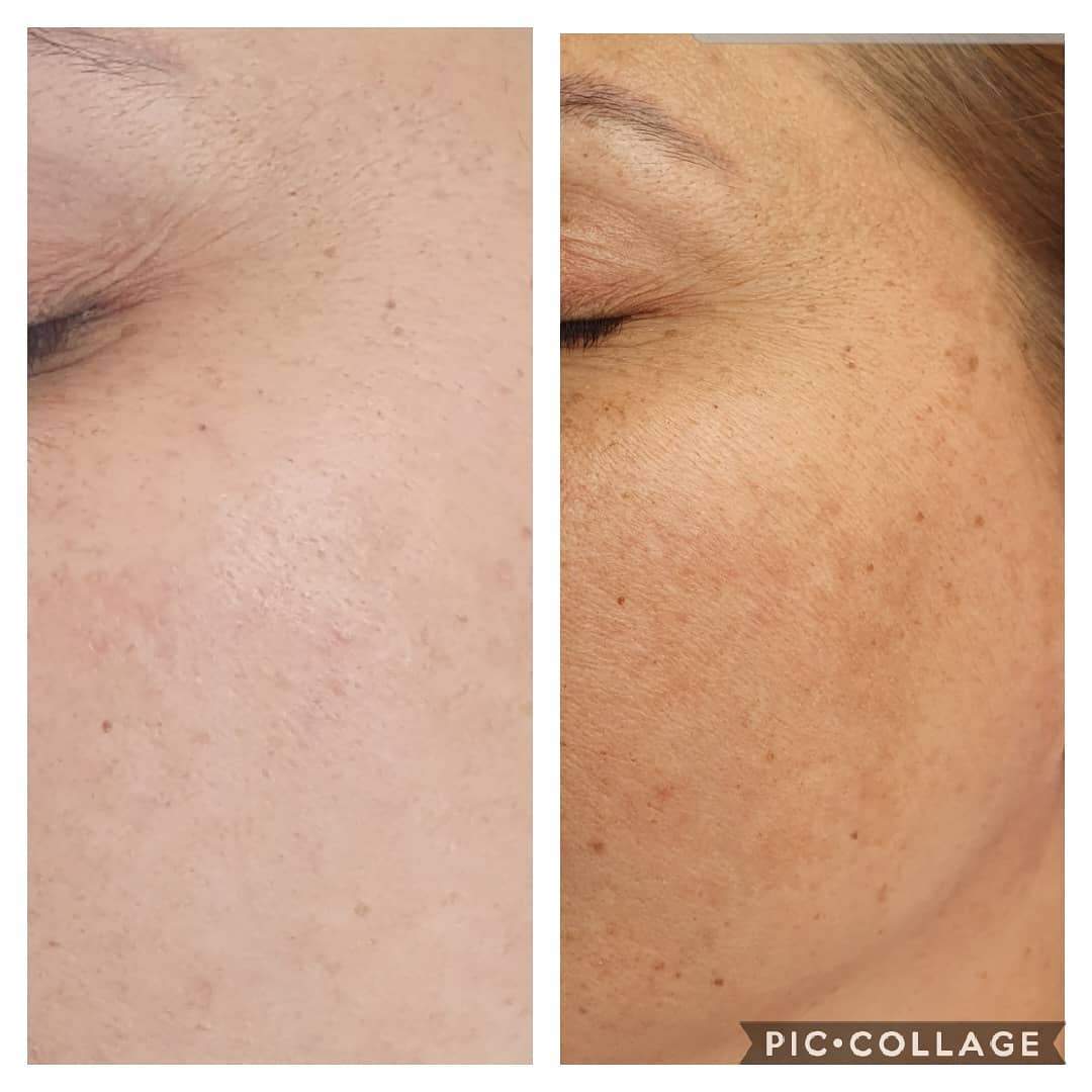 קוסמטיקאיות | לורנס סקין קאר