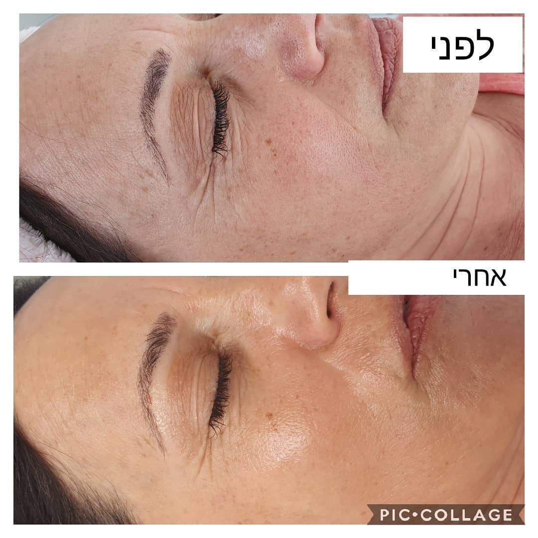 קוסמטיקאיות | לורנס סקין קאר