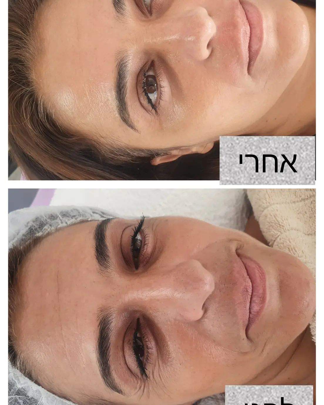 קוסמטיקאיות | לורנס סקין קאר