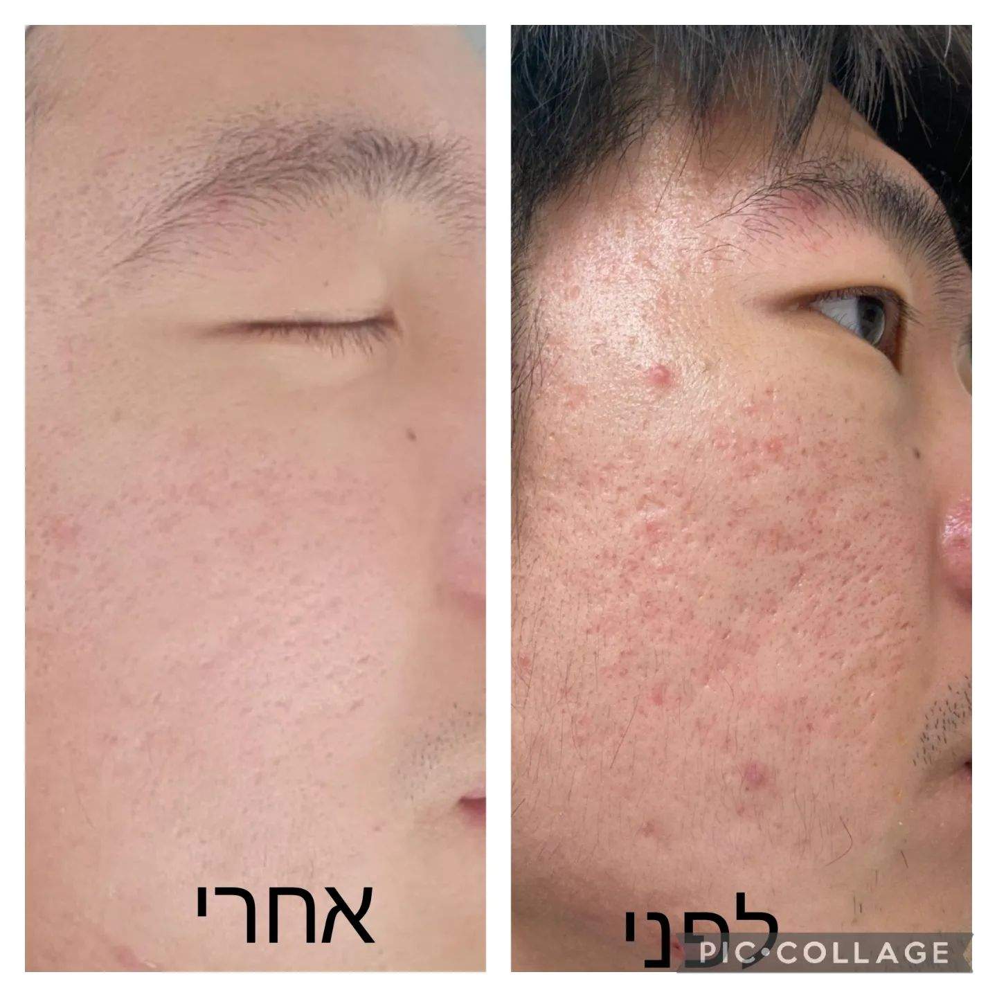 קוסמטיקאיות | לורנס סקין קאר