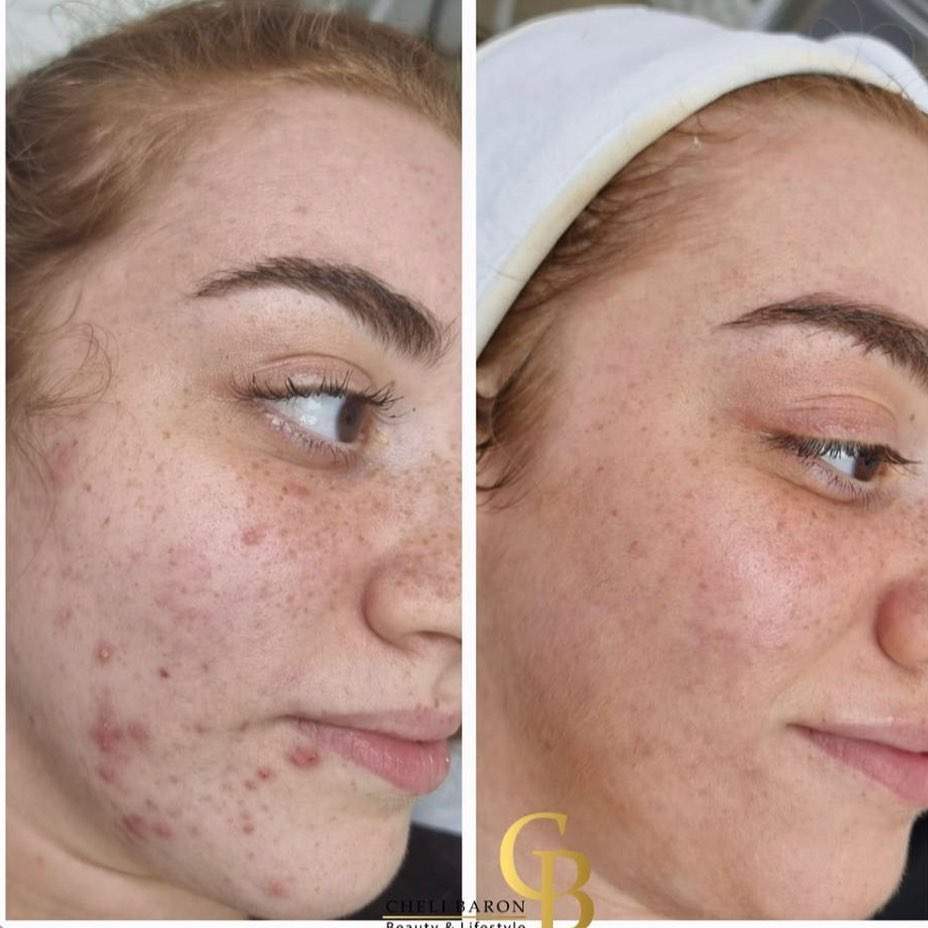 קוסמטיקאיות | חלי בראון המרכז לטיפולי לייזר ואסתטיקה