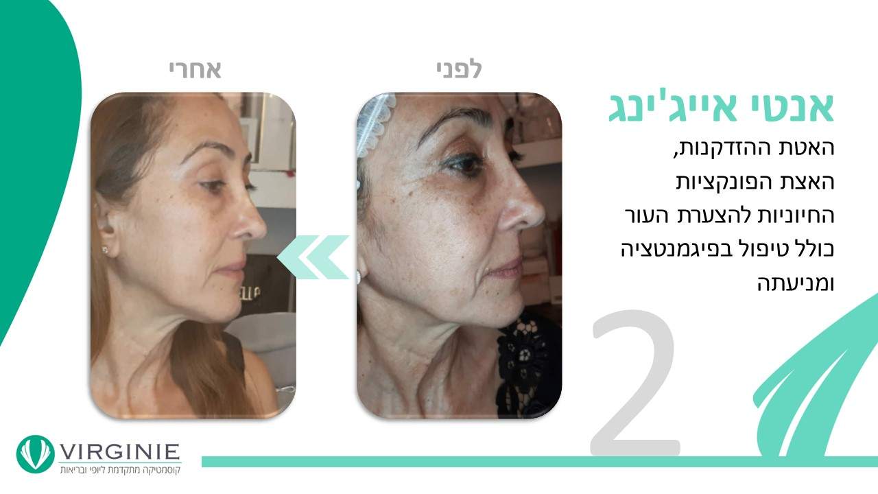 קוסמטיקאיות | וירג'יני קוסמטיקה מתקדמת ליופי ובריאות