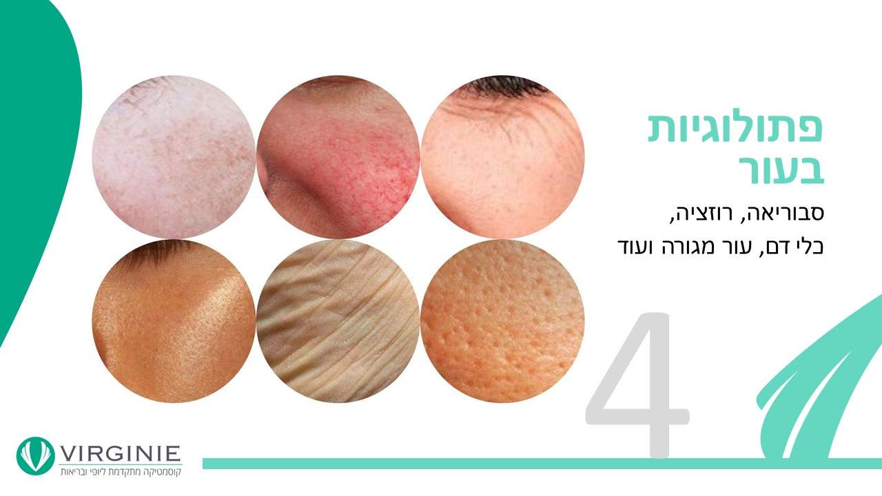 קוסמטיקאיות | וירג'יני קוסמטיקה מתקדמת ליופי ובריאות