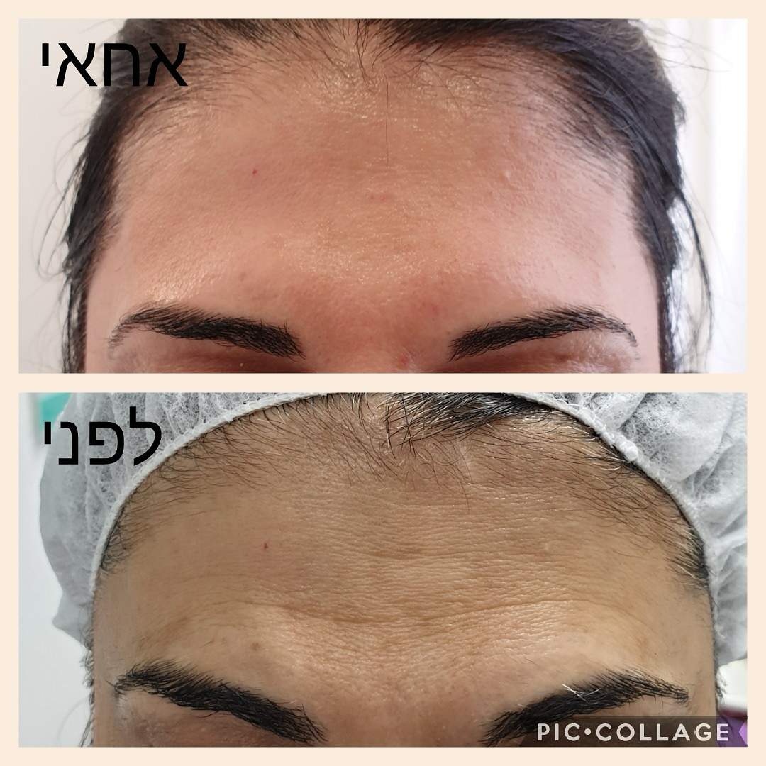 קוסמטיקאיות | נינה יעקובי