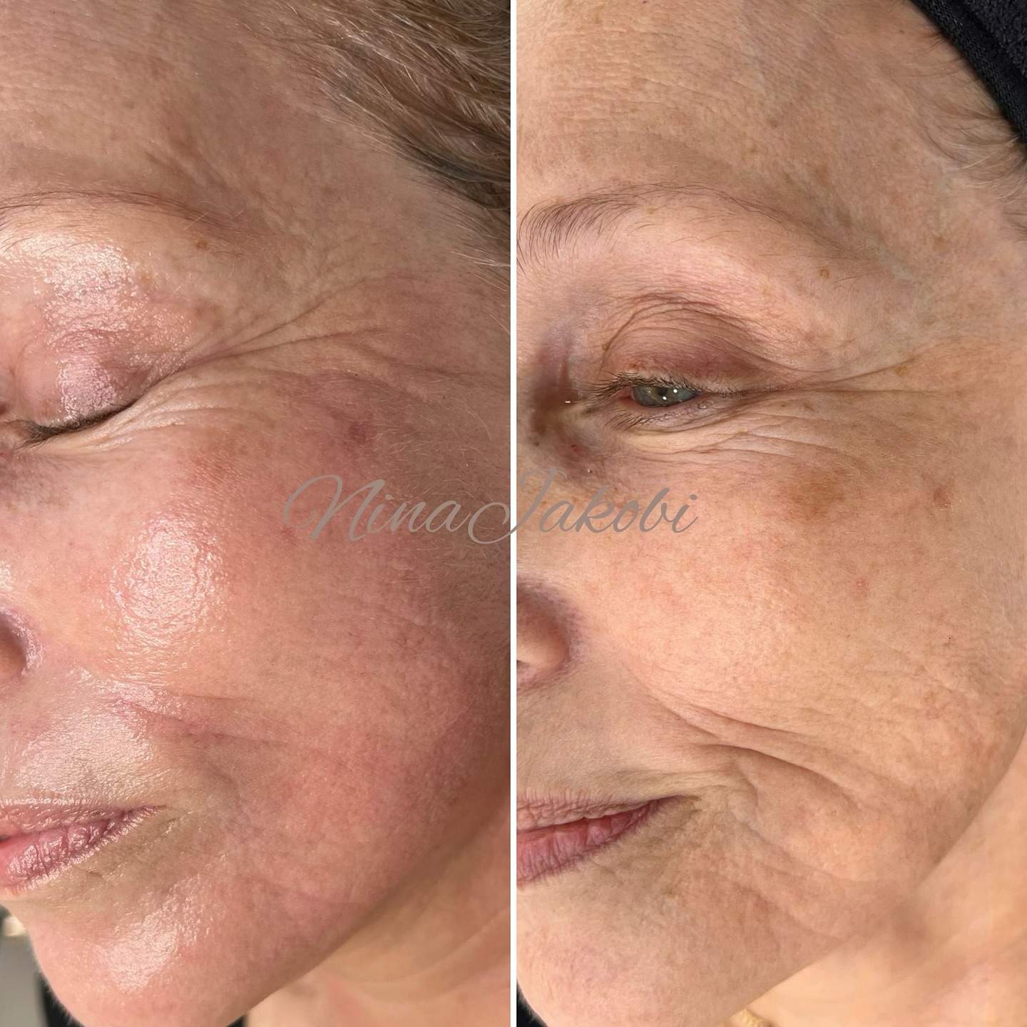 קוסמטיקאיות | נינה יעקובי