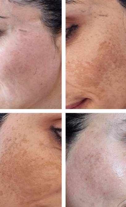 קוסמטיקאיות | נינה יעקובי