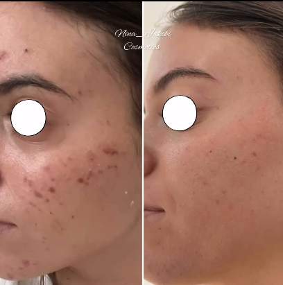 קוסמטיקאיות | נינה יעקובי