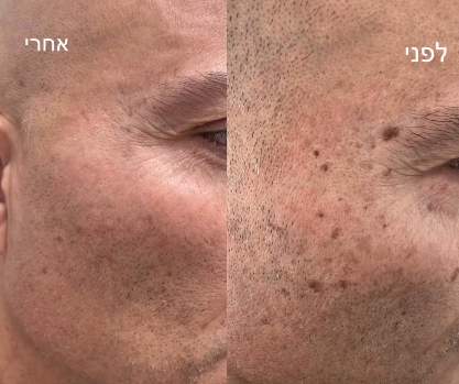 קוסמטיקאיות | נינה יעקובי