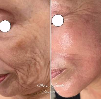 קוסמטיקאיות | נינה יעקובי